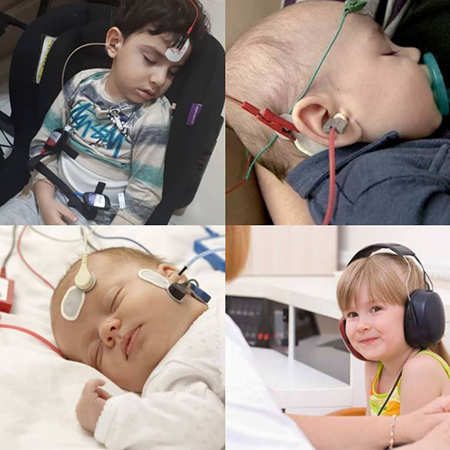 کم شنوایی در کودکان و روش های تشخیص و درمان