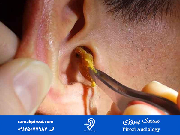 علل گوش درد چیست؟